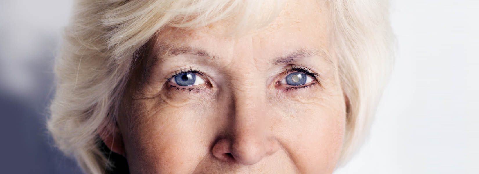 Cataract Surgery in Osage Beach